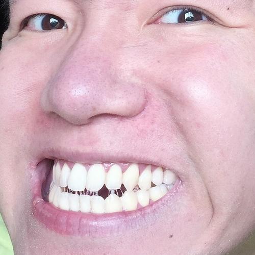Selfie